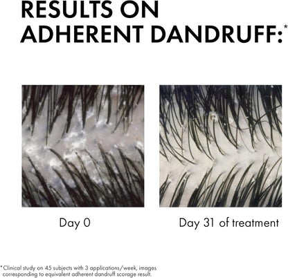 Vichy Dercos, Shampoo Trattamento Anti-Forfora, per Capelli Secchi, Allevia Senso Di Prurito, Forfora Visibile Ridotta, Arricchito Con Disolfuro Di Selenio, 390 Ml